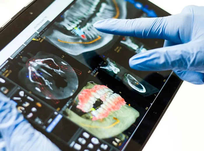 Radiografía panorámica dental en pantalla durante el diagnóstico