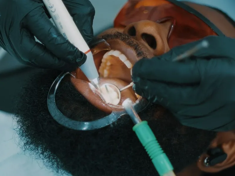 Procedimiento profesional de limpieza dental con instrumentos de precisión