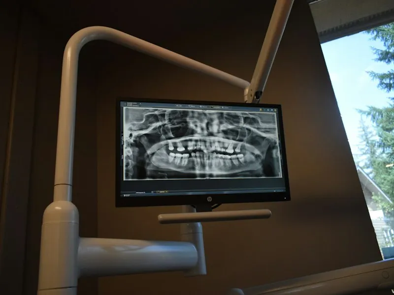 Radiografía dental en pantalla durante un procedimiento de endodoncia